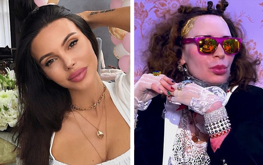    пластика звезд