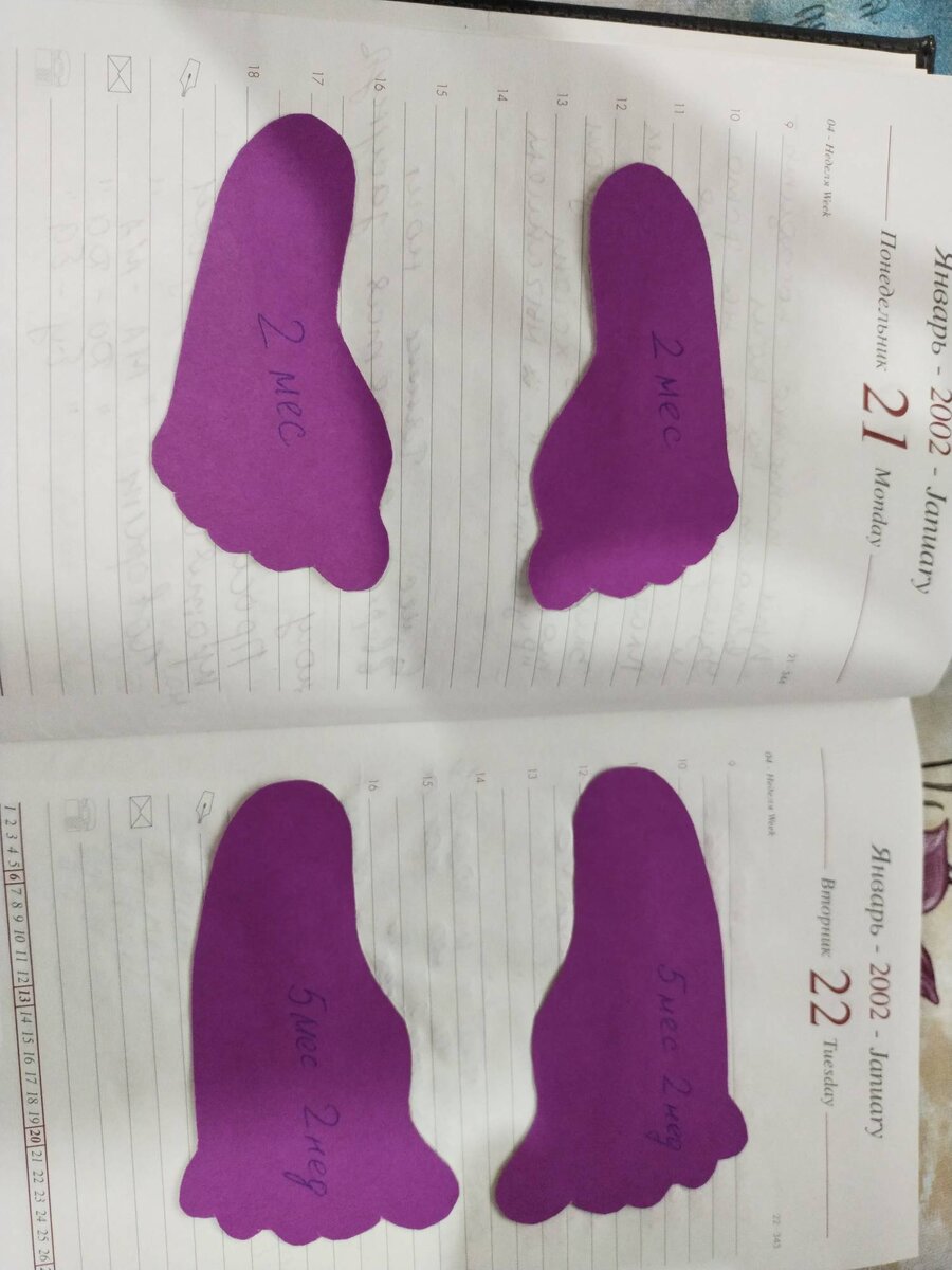 А у вас были такие пятки?