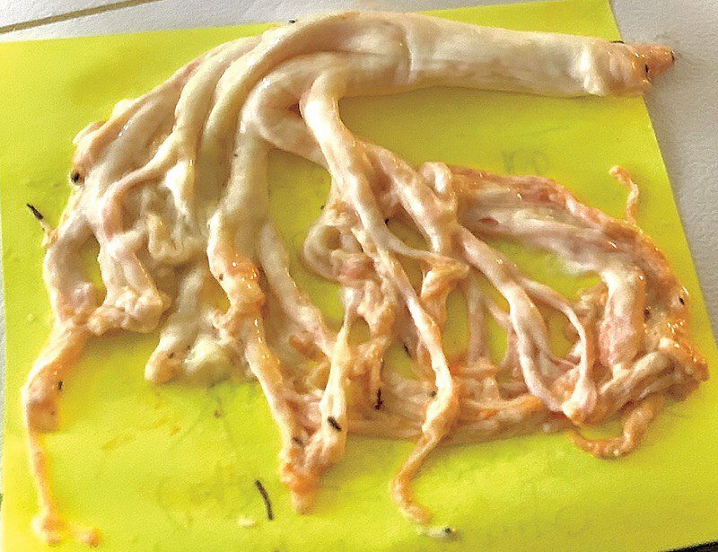 Фото 1. Слепок бронха.