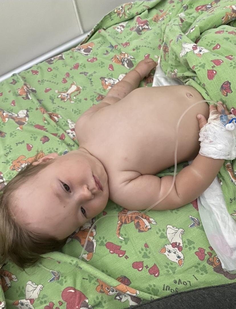 Фото первых дней болезни