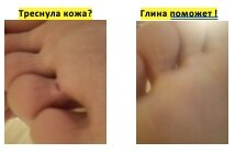 Результат ДО и ПОСЛЕ

