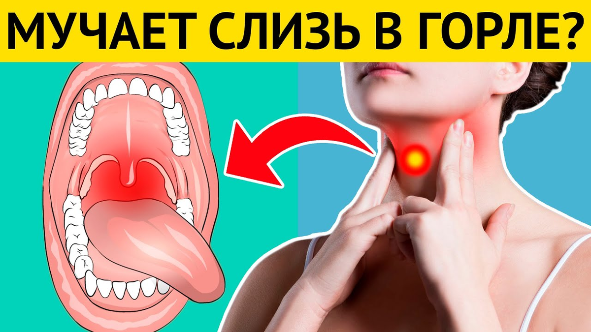 Слизь в горле и кашель как избавиться