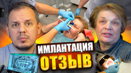 Tải video: ПАЦИЕНТ МУЧИЛСЯ С ИМПЛАНТАТАМИ 10 ЛЕТ / ОТЗЫВ / ISTOM CLINIC