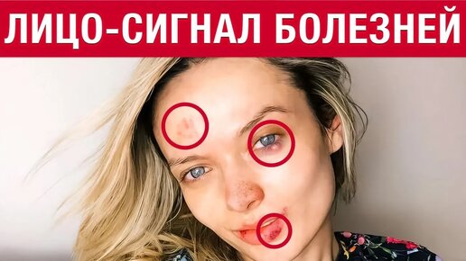 Ваше лицо КРИЧИТ вам о БОЛЕЗНЯХ! 5 болезней, которые ВИДНО на лице!