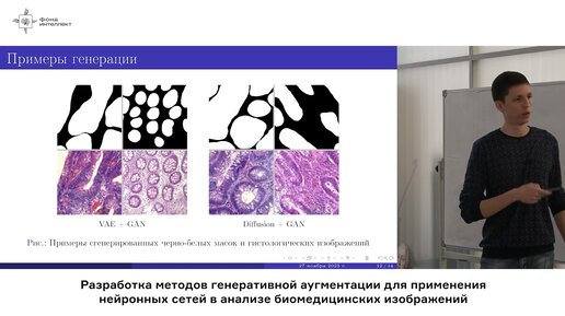 Карнаухов В.Е. - Разработка методов генеративной аугментации для применения нейронных сетей