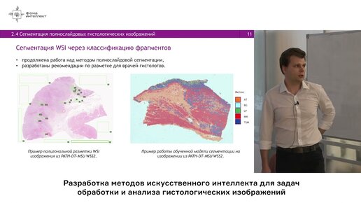 Хвостиков А.В. - Разработка методов ИИ для задач обработки и анализа гистологических изображений