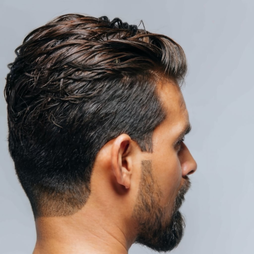 Как избавиться от перхоти