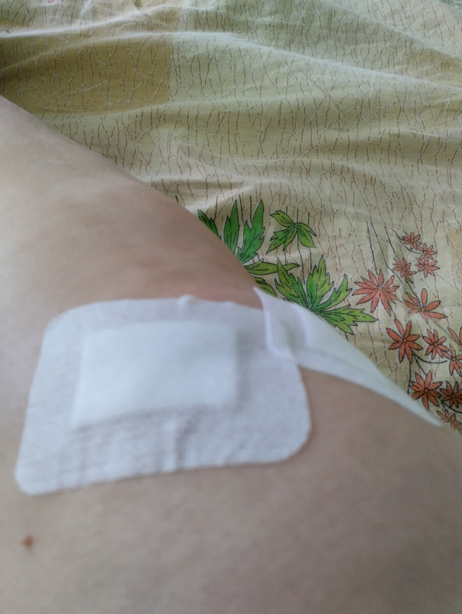 Мое оперированное колено