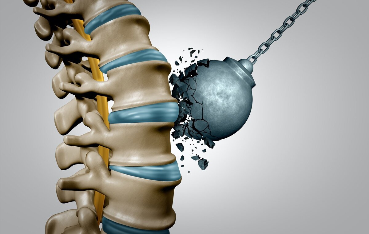 Кости в Spine