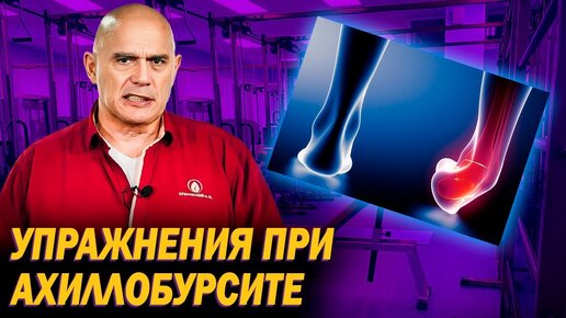 Тяжело ходить в 70, что делать? Ахиллобурсит: 3 упражнения, чтобы снять воспаление сустава стопы. Советы Бубновского для домашних условий