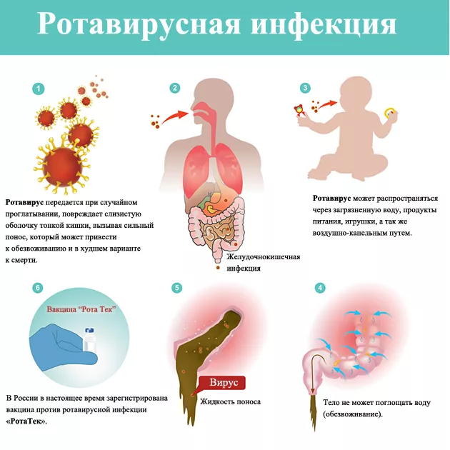 Ротавирусная инфекция у детей