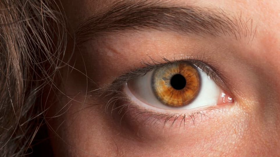 Желтый глаз 14. Центральная гетерохромия зрачок. Гетерохромия Радужки глаз. Болотный цвет глаз гетерохромия. Центральная гетерохромия карих глаз.
