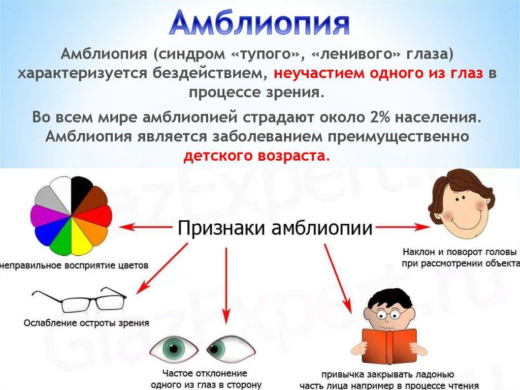 Что такое ленивый глаз. Амблиопия классификация по остроте зрения. Амблиопия у детей. Амблиопия (синдром ленивого глаза). Нарушение зрения косоглазие.