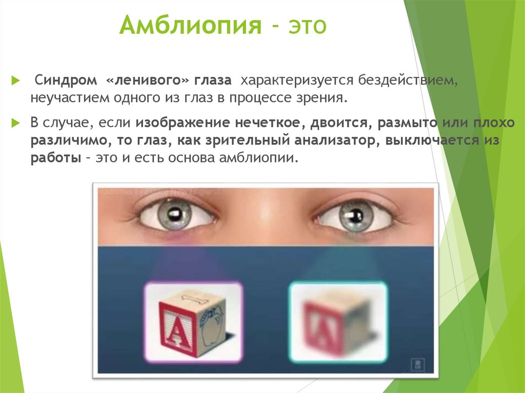 Критерии определения группы инвалидности по зрению. Реамед амблиопия. Амблиопия инвалидность. Амблиопия высокой степени. Группы инвалидности по зрению.