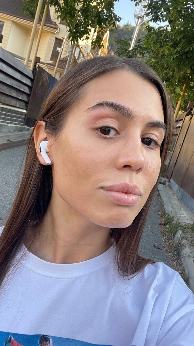 Одно из лучших состояний моей кожи за последние годы. Здесь я около двух недель не выдавливала воспаления и намного меньше трогала лицо руками.