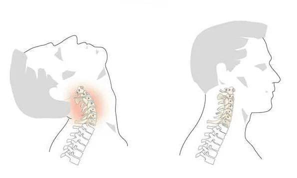 Тест на остеохондроз: как определить наличие проблем с позвоночником ...