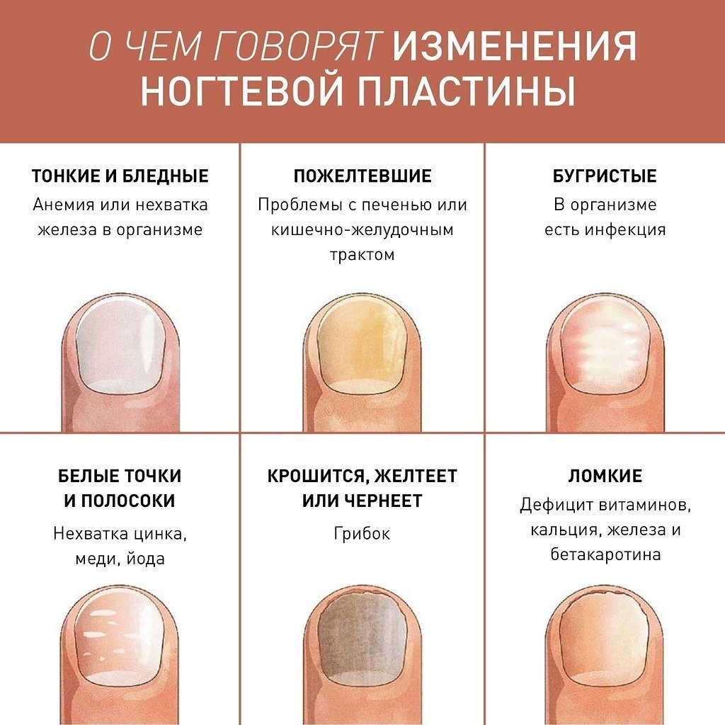 Доктор по ногтям как называется