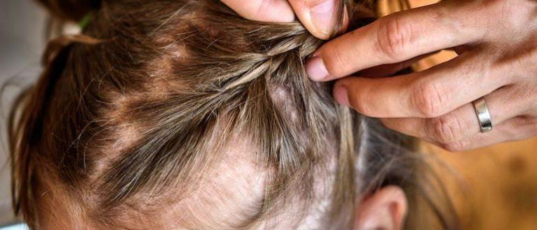 Норма выпадения волос у детей 4 лет.