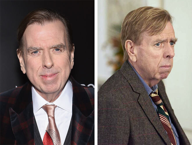 Недоразвитый подбородок