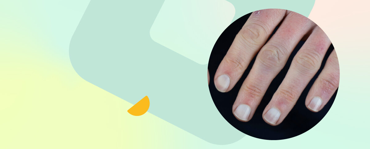 Рассказали и показали, как меняются ногти при нарушениях в работе организма. У каждого человека под рукой есть личный диагностический центр — ногти.-3