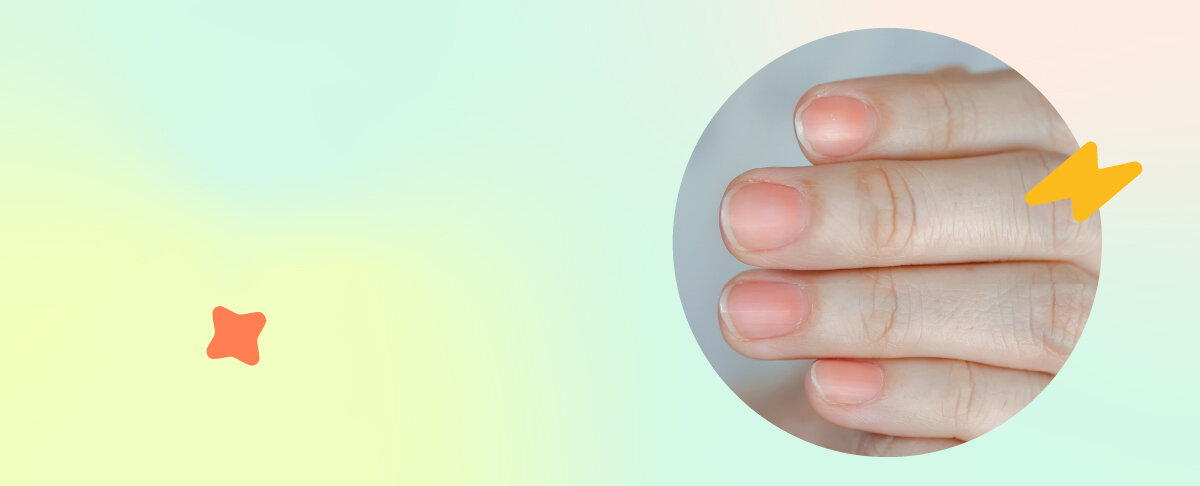 Рассказали и показали, как меняются ногти при нарушениях в работе организма. У каждого человека под рукой есть личный диагностический центр &mdash; ногти.-4