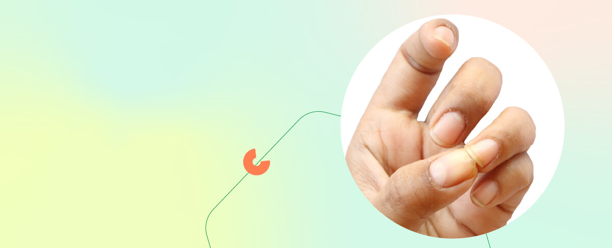 Рассказали и показали, как меняются ногти при нарушениях в работе организма. У каждого человека под рукой есть личный диагностический центр &mdash; ногти.-6