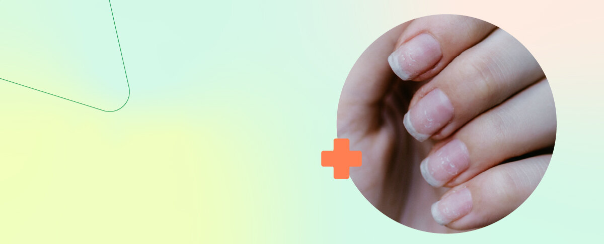 Рассказали и показали, как меняются ногти при нарушениях в работе организма. У каждого человека под рукой есть личный диагностический центр &mdash; ногти.-9