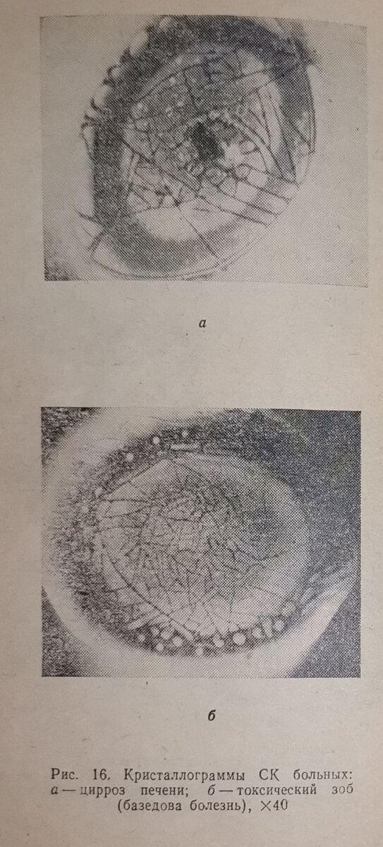 Высушенная сыворотка крови под микроскопом, увеличение х40