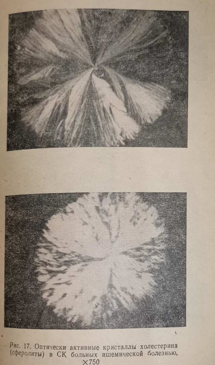 Высушенная сыворотка крови под микроскопом