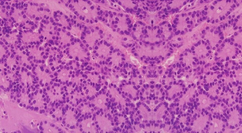   Ugo Cioffi et al. / World Journal of Surgical Oncology, 2016