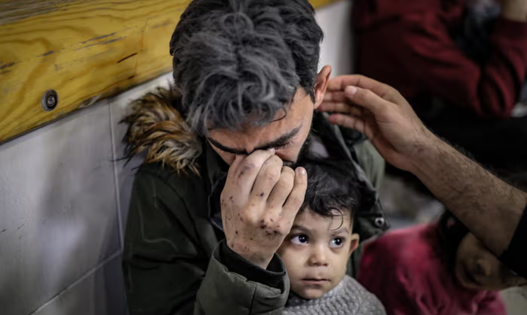 Фото: Anadolu/Getty Images