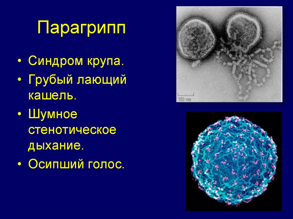 Возбудитель гриппа орви