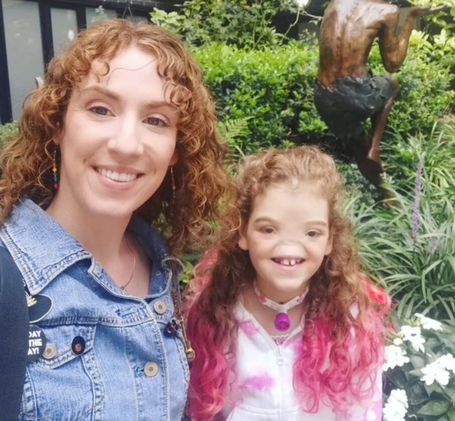 Проблемы с внешностью могут быть тяжелым испытанием для многих людей. Однако только представьте, каково это - быть девочкой, которая родилась без носа. Малышке, которой от природы не удалось обрести это важное часть своего лица, пришлось пройти через немало трудностей с самого раннего детства.