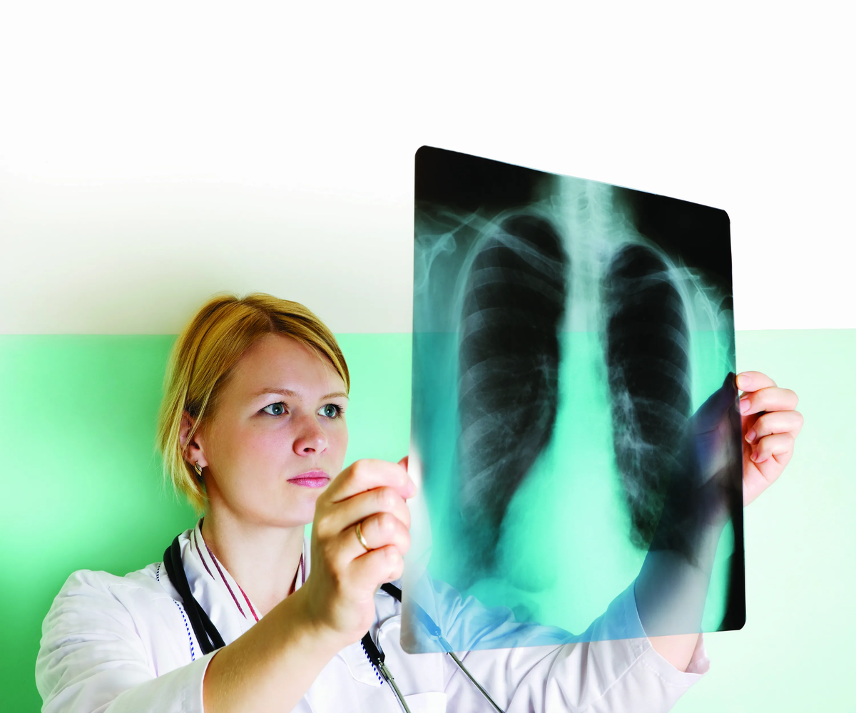 Рентген. Рентгенография органов дыхания. Туберкулез у пожилых