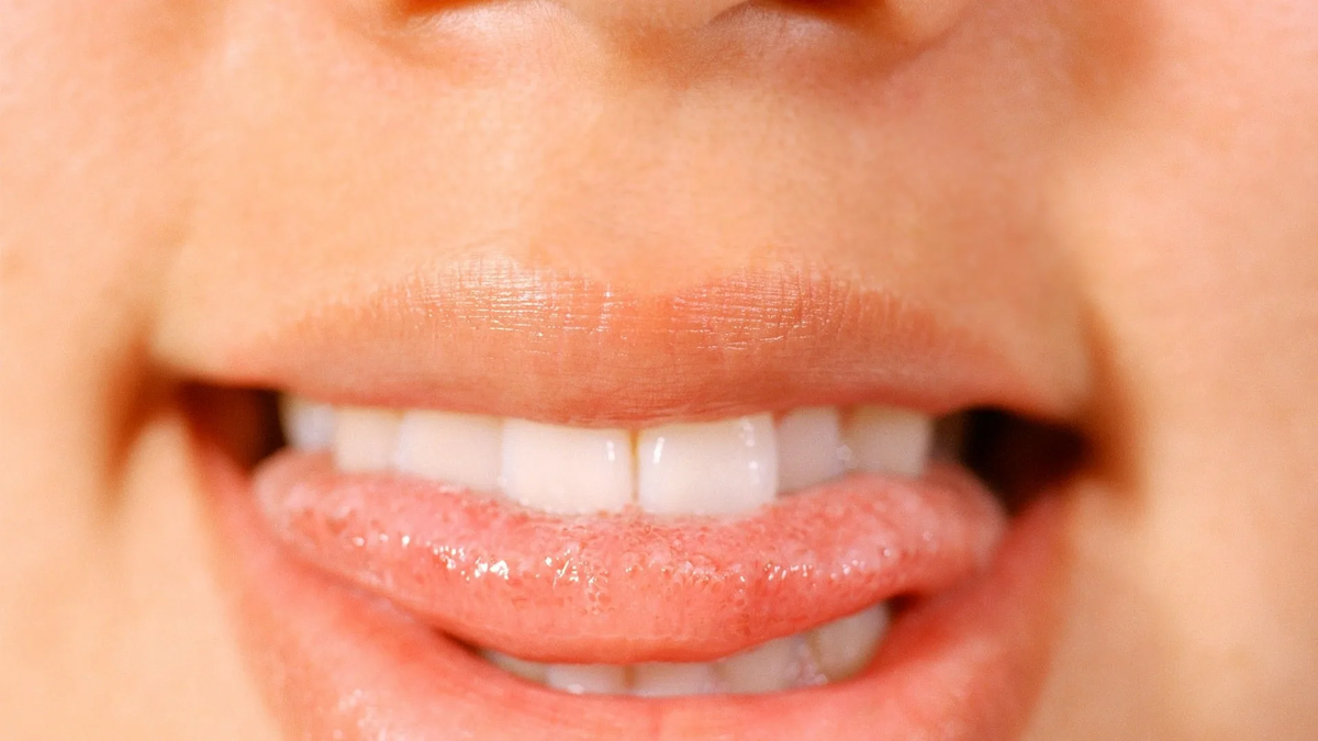 Прокладывание языка между зубами.