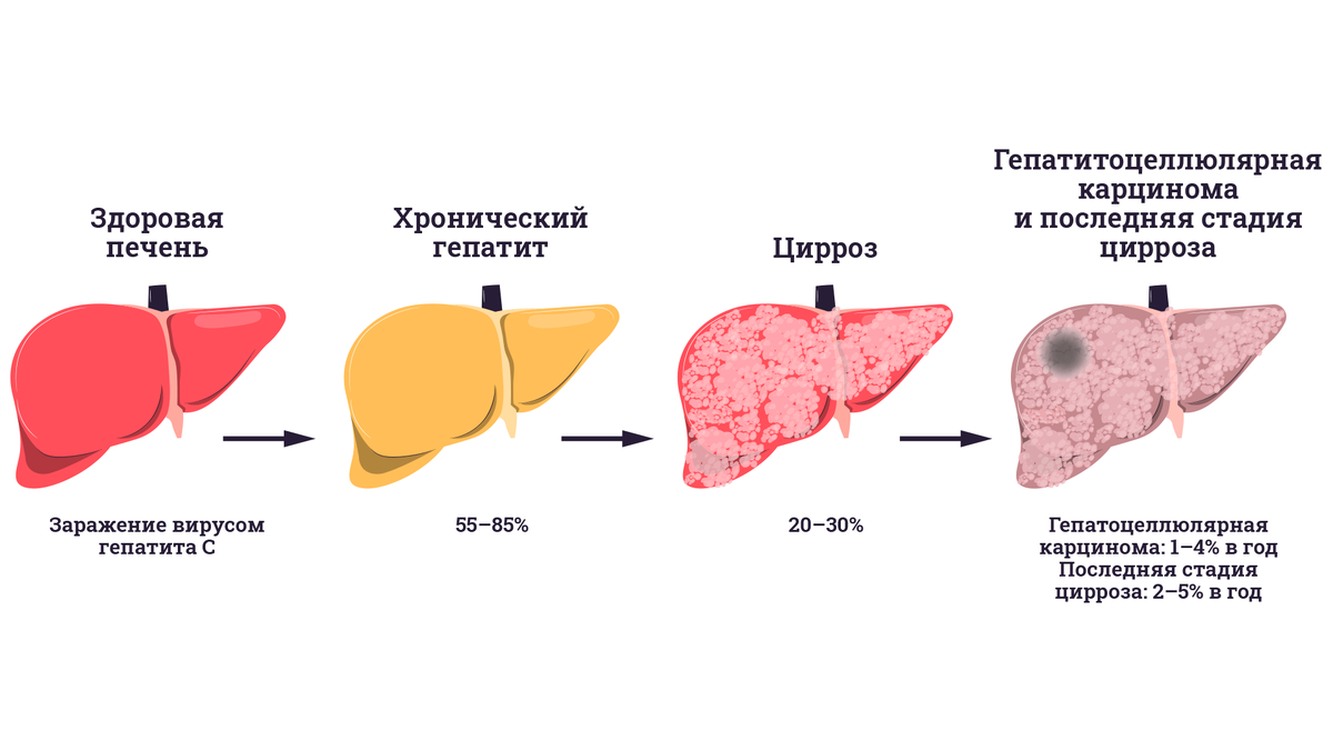 Лечится ли гепатит B?