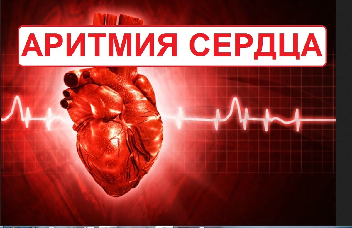 Аритмию сердца современные препараты для лечения