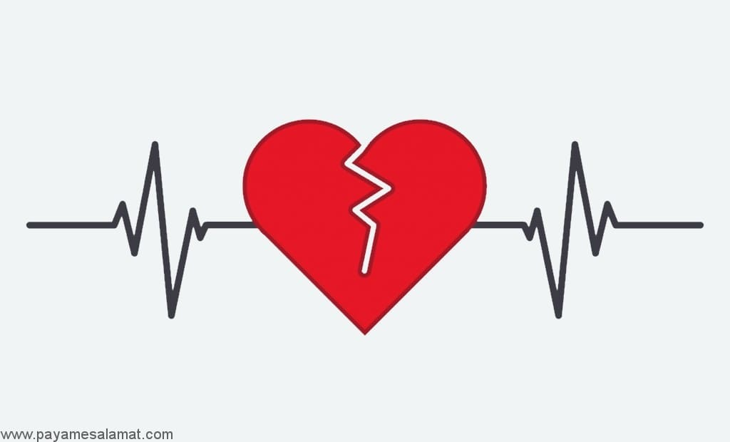 Экстрасистолов. Аритмия рисунок. Аритмия на кардиограмме. Нарушение ритма. Кардиограмма сердца.