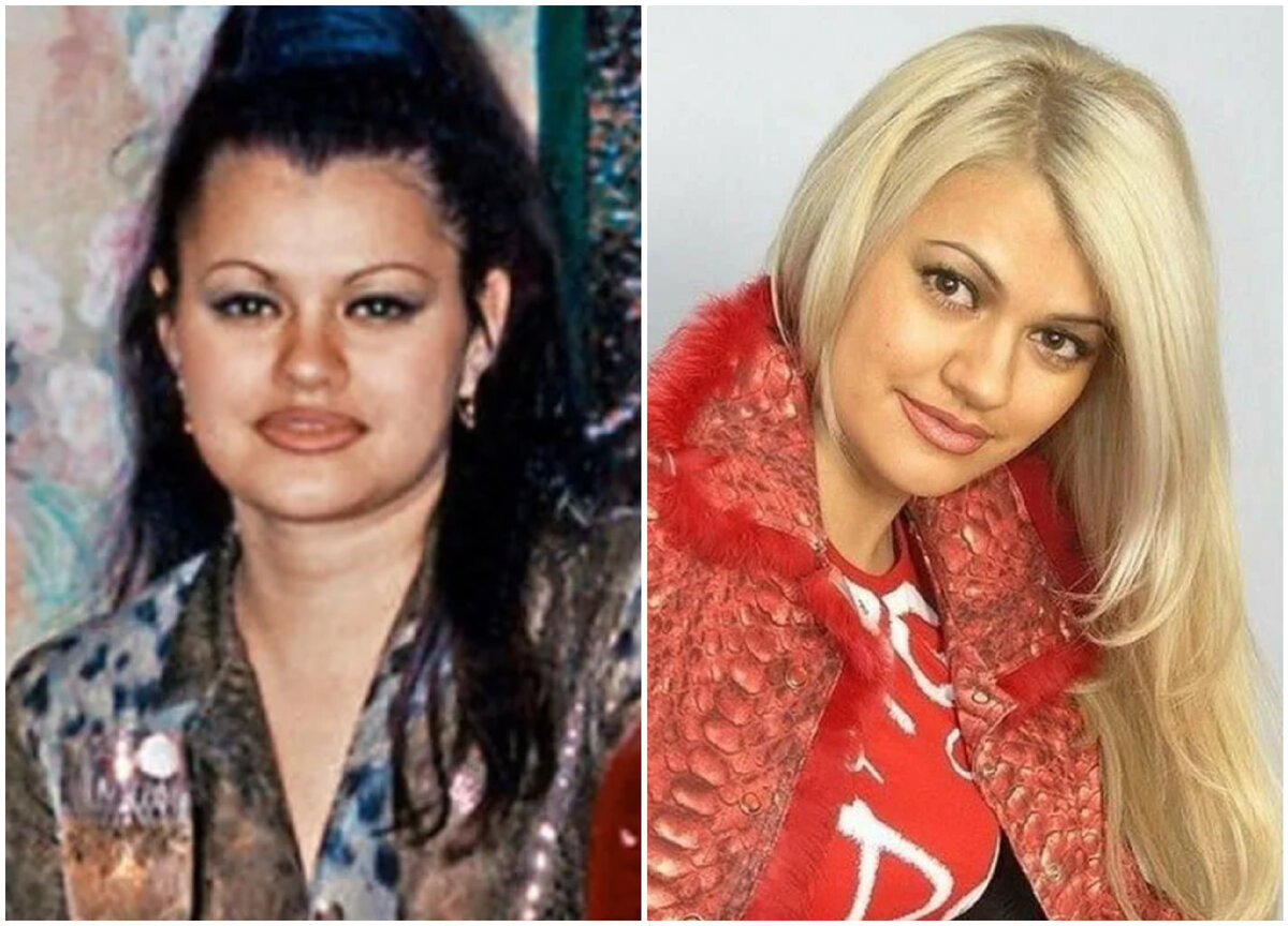 Ирина круг до пластики фото