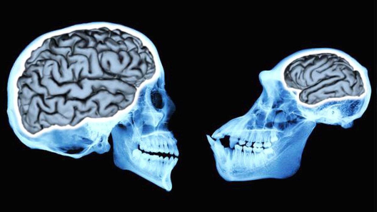 Какой мозг у приматов. Мозг человека и обезья. Мозг человека и мозг обезьяны. Мозг человека и приматов. Головной мозг человека и обезьяна.