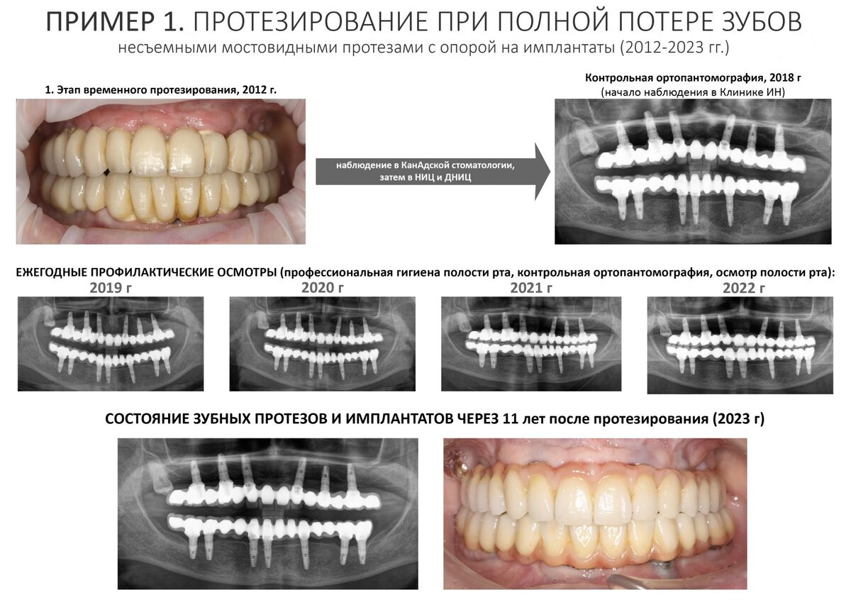 почему бесконечная установка в стиме фото 29