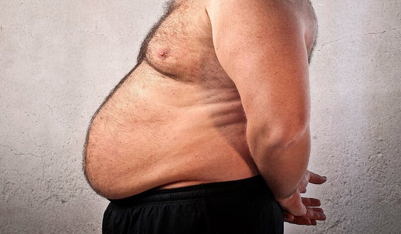 Абдоминальное ожирение