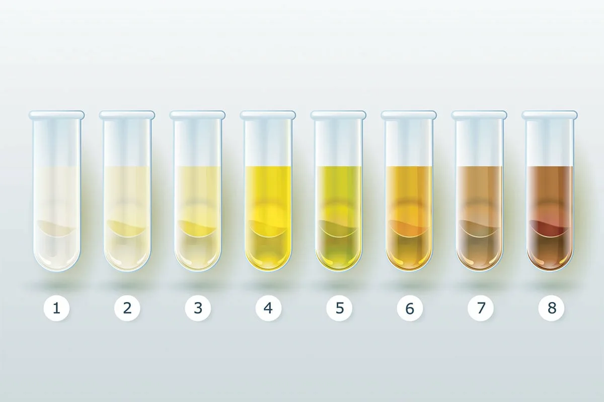 Почему появляются лейкоциты в моче у женщин: какие болезни могут быть ...