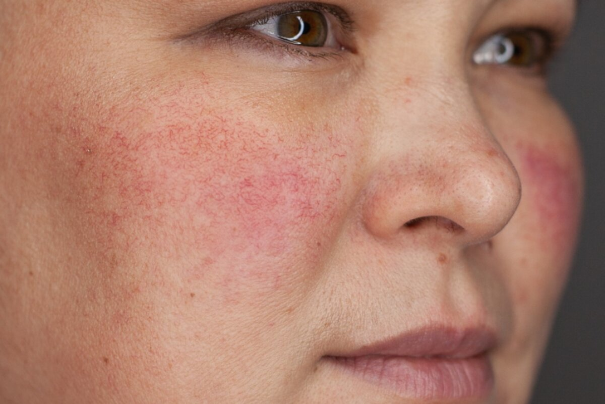 Фотография взята из источника yandex.ru