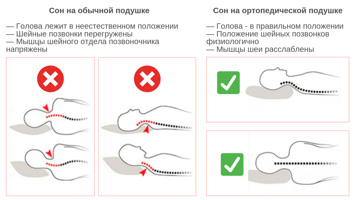 На каком матрасе лучше спать с больной спиной и шеей