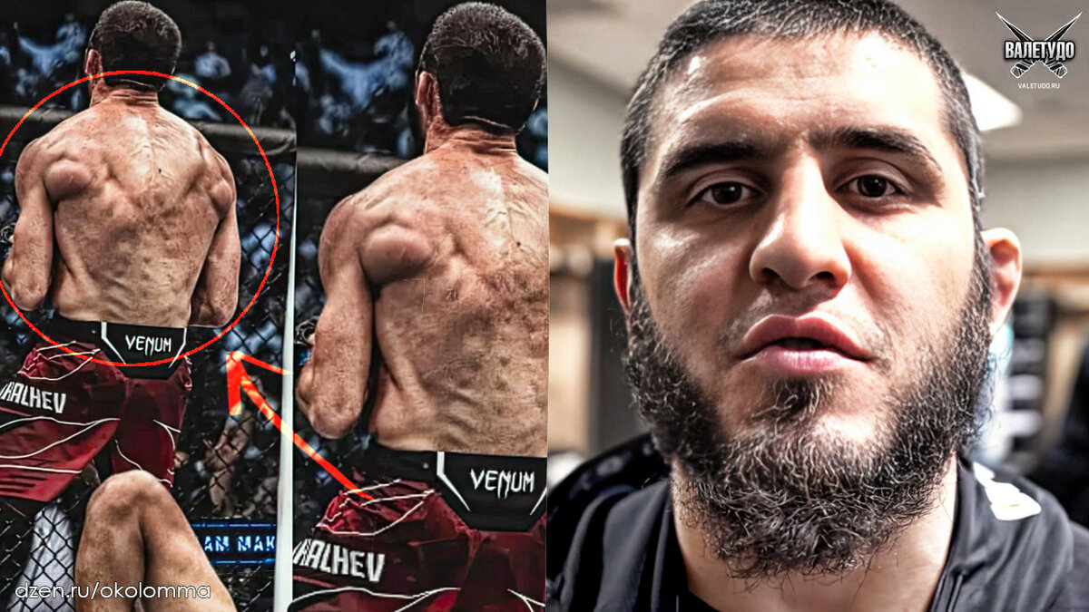 Ислам Махачев и его натуральная спина | valetudo.ru 