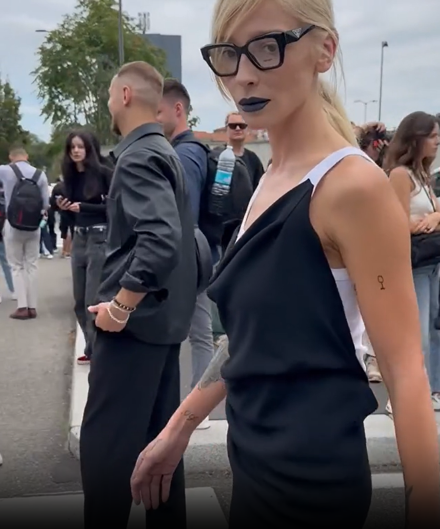Как Ивлеева превратилась из красивой девушки в человека с нездоровой ...