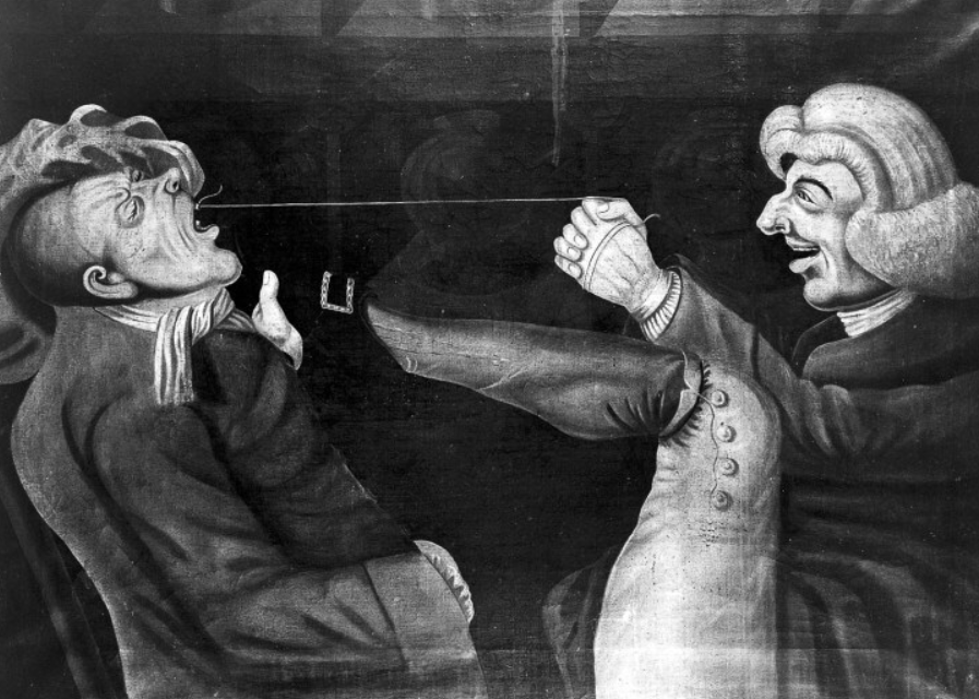 Дедовский способ вырывания зубов нитью тоже работал