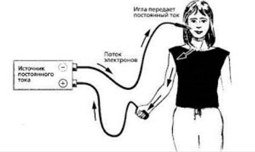 Применение тока в медицине. Аппарат электрофорез поток схем. Схема воздействия электрофореза на человека. Аппараты для электрофореза физиотерапия. Магнитотерапия схема воздействия.