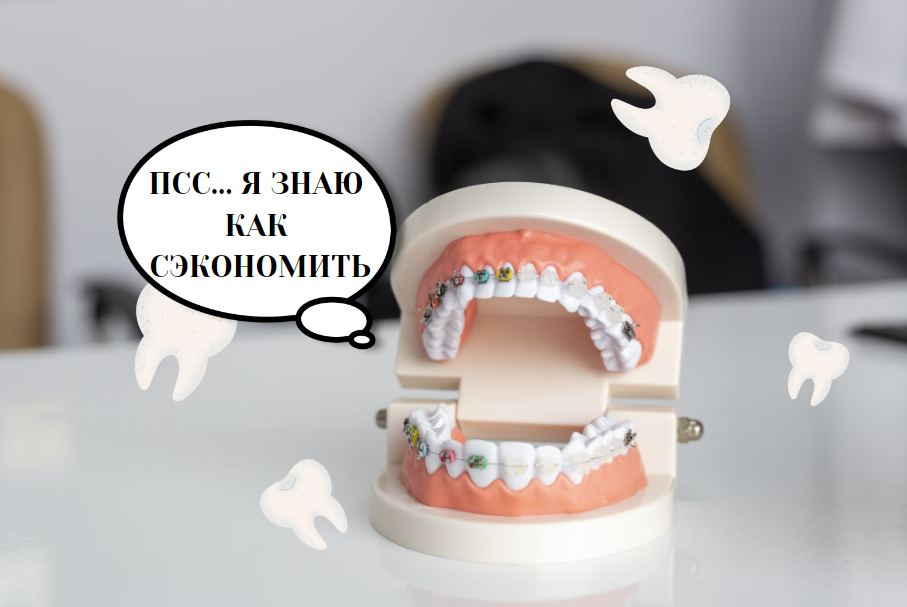 Как вернуть 15 600 рублей за полную имплантацию челюсти в 2024 году ...